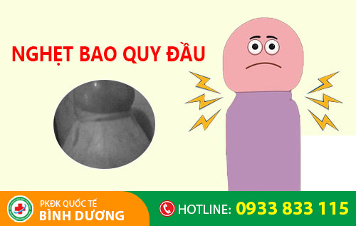 Hình ảnh bệnh về bao quy đầu nghẹt ở nam giới