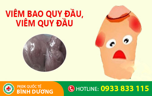 Hình ảnh viêm bao quy đầu, viêm quy đầu