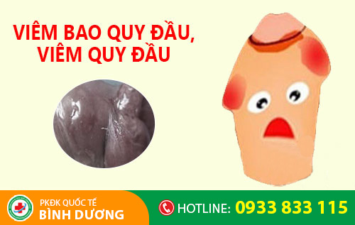 Biểu hiện viêm bao quy đầu ở nam giới