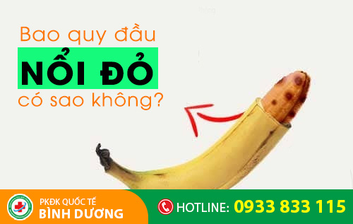 Bao quy đầu nổi đỏ, nổi hạt do nhiều nguyên nhân gây nên