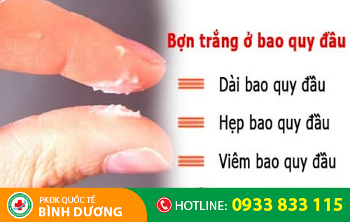 Viêm bao quy đầu làm xuất hiện các bợn trắng