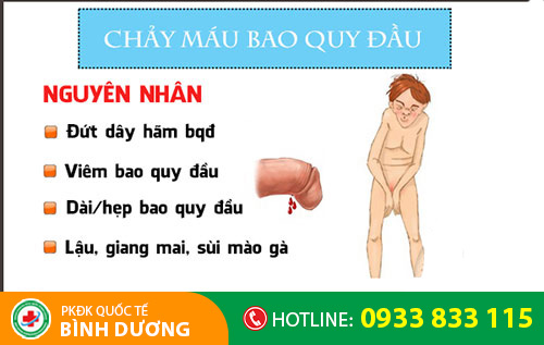 Chảy máu bao quy đầu chớ dại xem thường