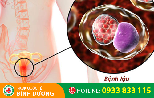 Nguyên nhân đi giải ra máu