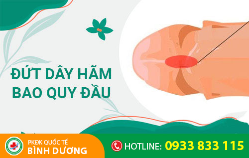 Đứt dây hãm bao quy đầu