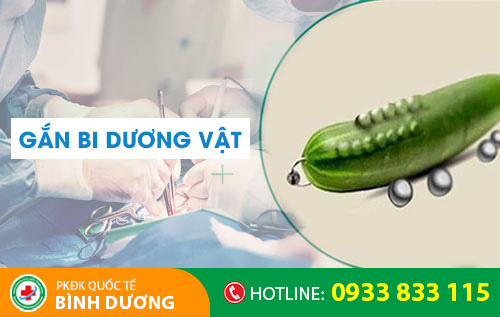 Gắn bi dương vật