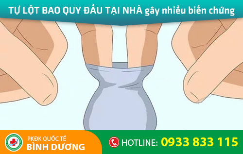 Tự lột bao quy đầu tại nhà gây nhiều biến chứng nguy hiểm