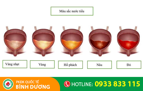 Màu sắc nước tiểu