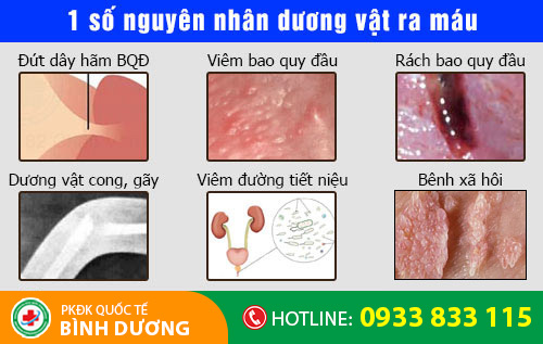 Dương vật ra máu do nhiều bệnh lý nguy hiểm