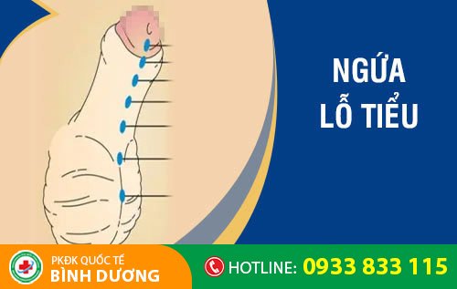 Ngứa lỗ tiểu