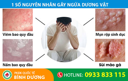 Ngứa dương vật là dấu hiệu nhiều bệnh nguy hiểm