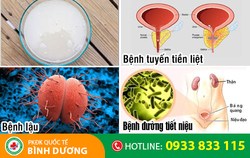 Một số nguyên nhân gây nước tiểu đục