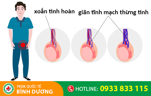 Nhóm bệnh tinh hoàn gồm có: xoắn tinh hoàn, giãn tĩnh mạch thừng tinh,...