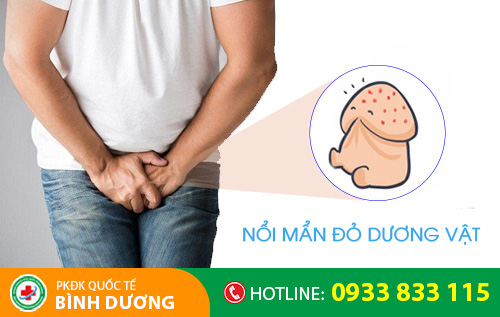 Dương vật bị nổi mẩn đỏ do nguyên nhân nào?