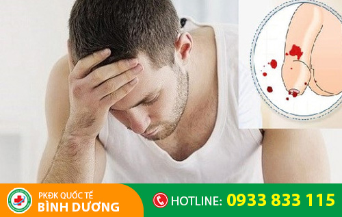 Rách dương vật có thể do nhiều nguyên nhân