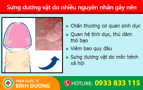 Sưng dương vật do nhiều nguyên nhân gây nên