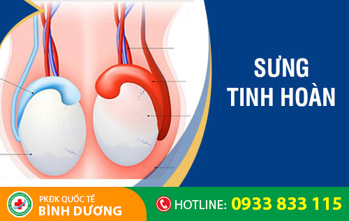Sưng tinh hoàn là dấu hiệu bệnh gì?