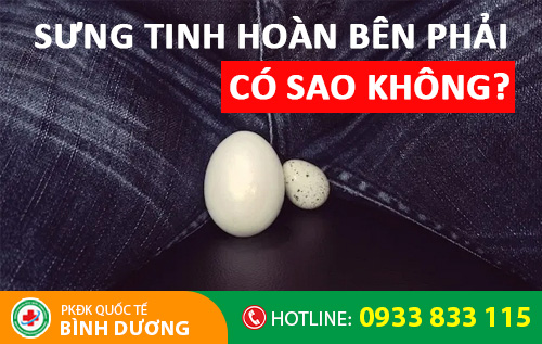 Sưng tinh hoàn bên phải cảnh báo nam giới nhiều bệnh nam khoa nguy hiểm