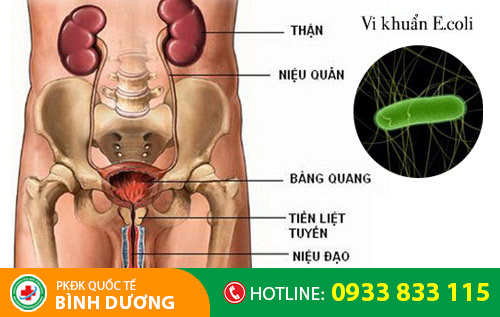 Các bệnh về đường tiết niệu, tuyến tiền liệt và niệu đạo có thể gây tiểu ra máu