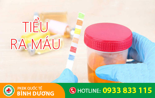 Tiểu ra máu khiến chị em thường xuyên bất an, lo lắng