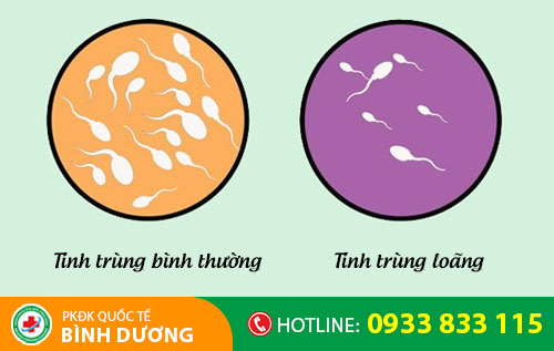 Tinh trùng loãng