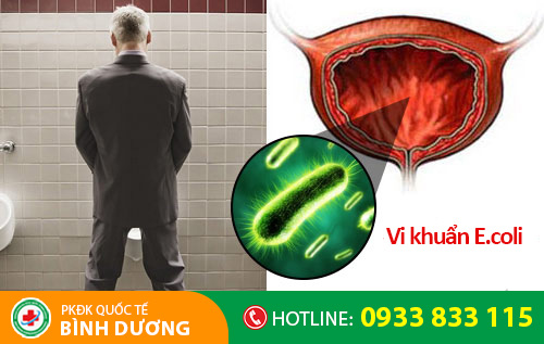 Viêm đường tiết niệu do vi khuẩn E.coli gây ra