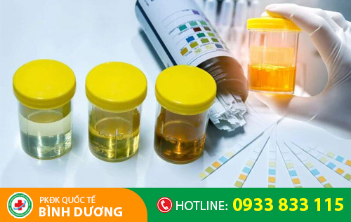 Xét nghiệm nước tiểu giúp phát hiện nhiều bệnh