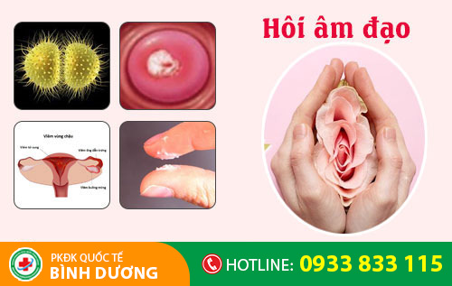 Hôi âm đạo