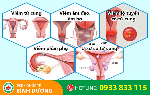 Nguyên nhân huyết trắng có màu