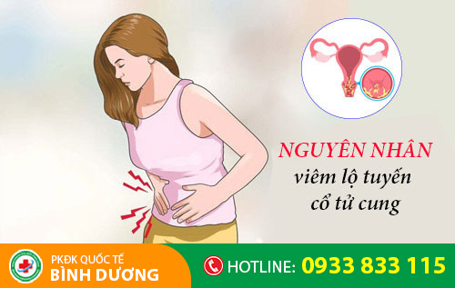 Nguyên nhân viêm lộ tuyến cổ tử cung