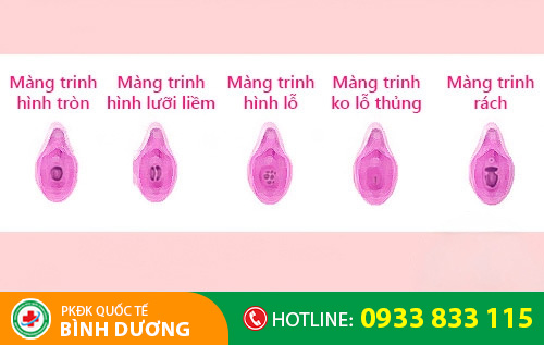 Các dạng màng trinh