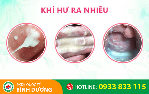 dấu hiệu viêm vùng kín