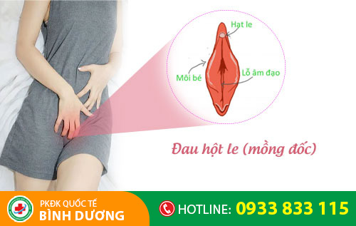 Đau hột le (mồng đốc)