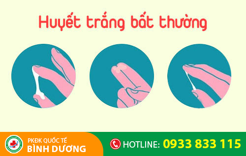 Huyết trắng bất thường