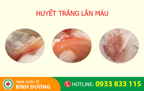Huyết trắng lẫn máu