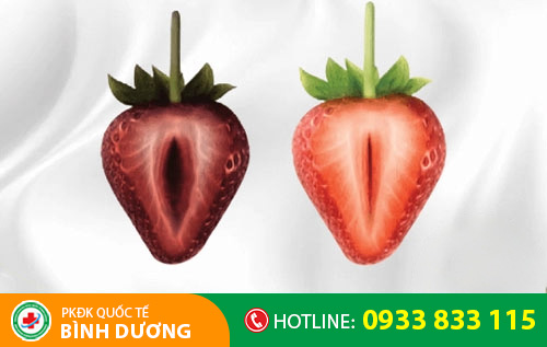 Kết quả sau khi thu hẹp âm đạo