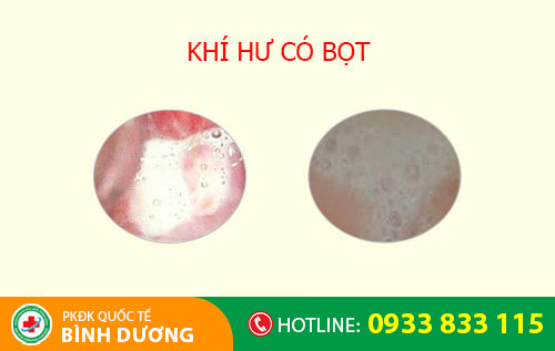 Khí hư có bọt