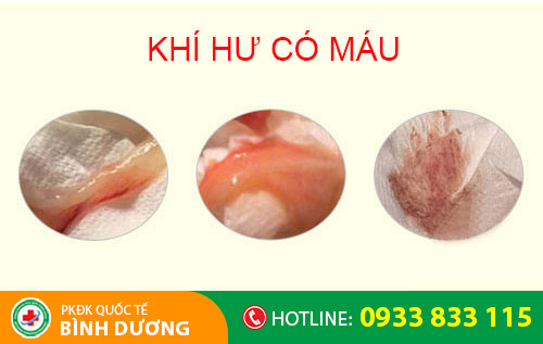 Khí hư có máu