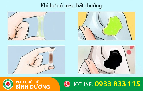 Khí hư có màu - dấu hiệu cảnh báo một số bệnh phụ khoa