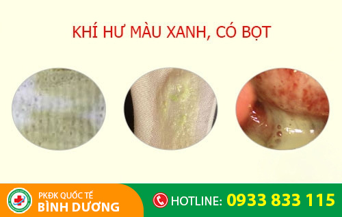 Khí hư màu xanh có bọt