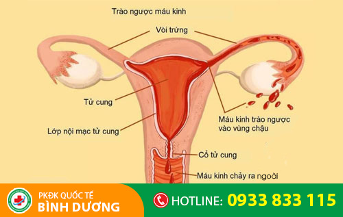 Kinh nguyệt không đều kéo dài có thể là do bệnh phụ khoa gây nên