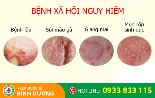 Nguyên nhân âm đạo có mùi