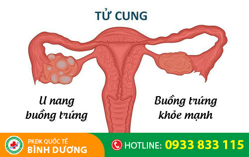 Nguyên nhân đau rát khi quan hệ