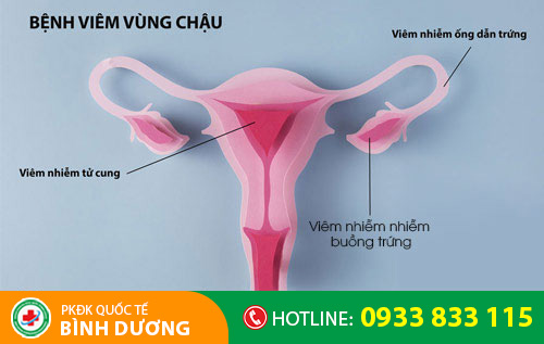 Nguyên nhân gây đau bụng dưới