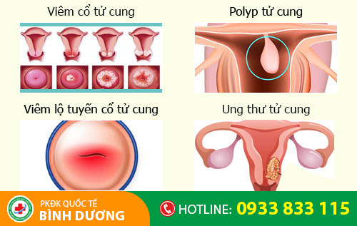 Nguyên nhân kinh nguyệt kéo dài