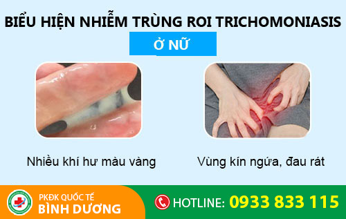 Nhiễm trichomonas ở nữ giới