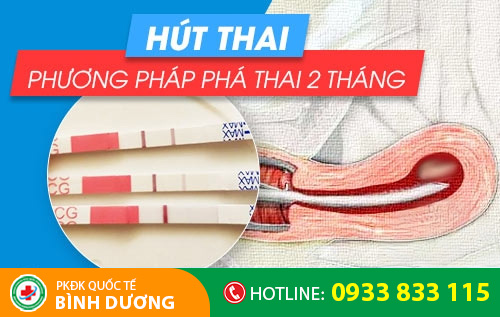 Hút thai – phương pháp phá thai 2 tháng an toàn