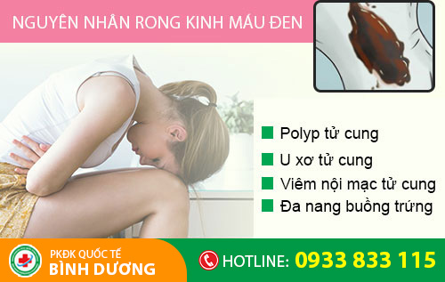 Rong kinh máu đen