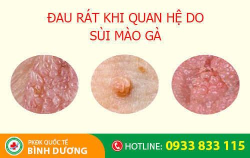 nguyên nhân đau rát khi quan hệ
