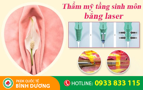 Thẩm mỹ tầng sinh môn bằng phương pháp Laser