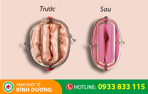 Thu hẹp âm đạo